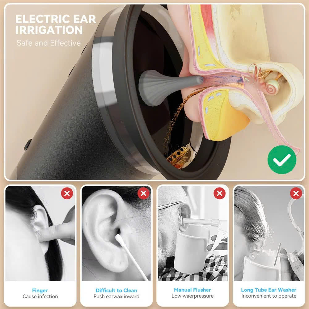 GENTLE EAR IRRIGATION KIT